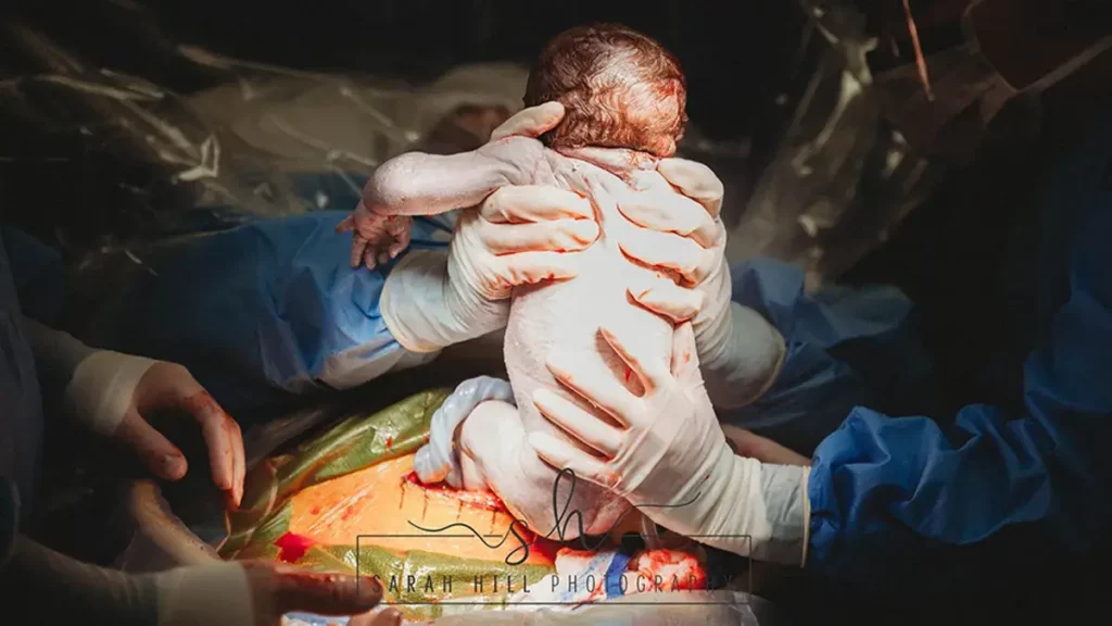 gentle c section mum pulling baby out