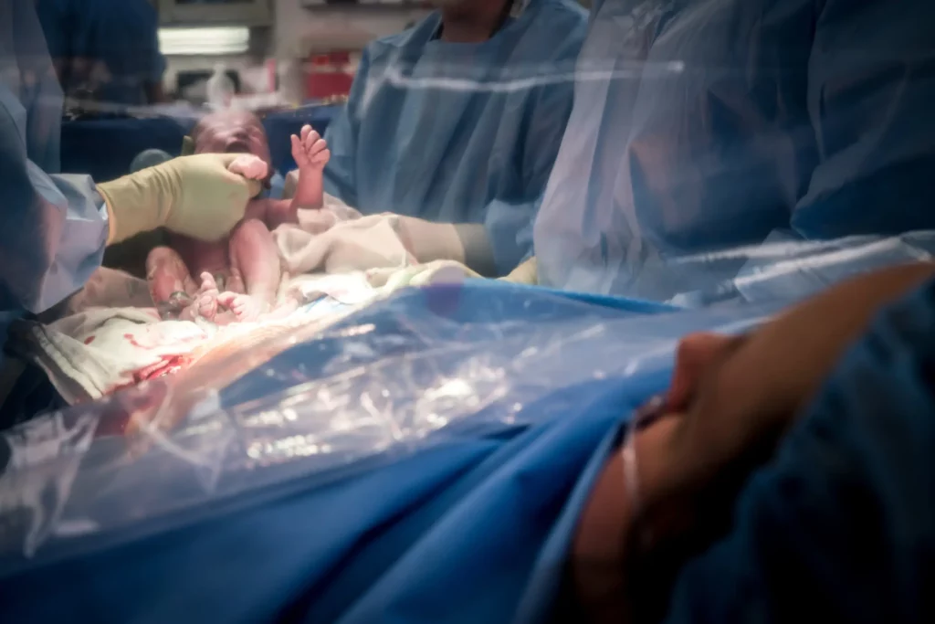 looking through clear drape gentle c section
