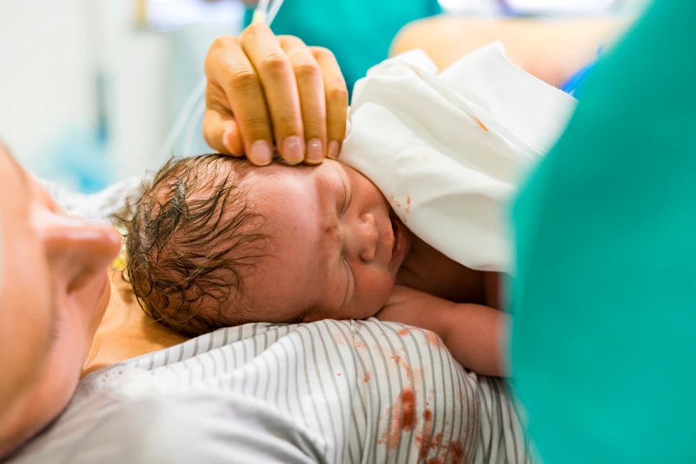 what is a gentle c section